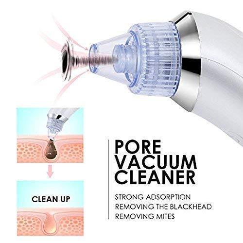 Blackhead Remover /Pimple pore cleaner(4 in 1)